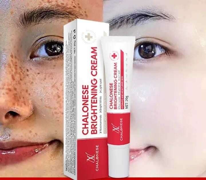 CHALONESE Brightening Cream Serum 20g | Dark Spot Correcting Face Cream | Herbal Moisturizing Glow Cream for Women & Men