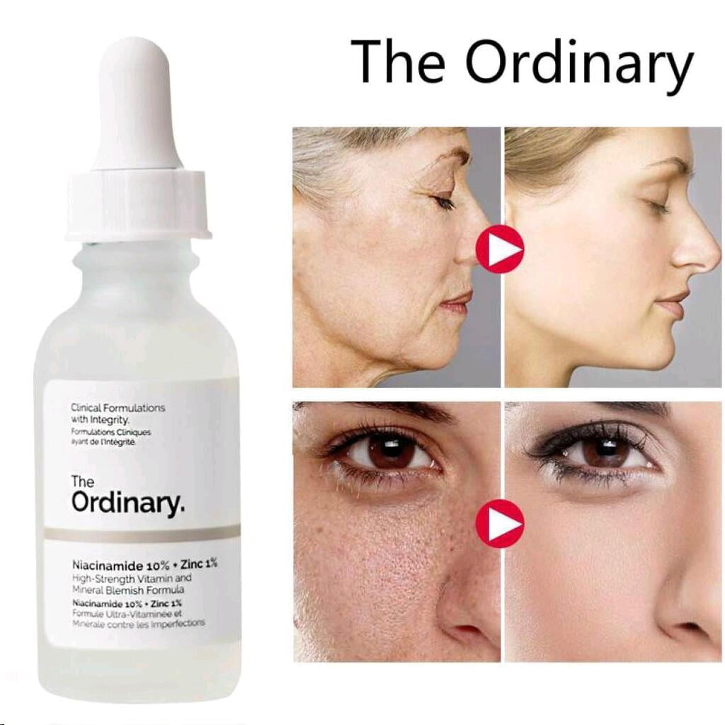 The Ordinary Niacinamide 10% + Zinc 1% Face Serum – Oil Control, Acne Treatment & Skin Brightening Serum for Clear Glowing Skin