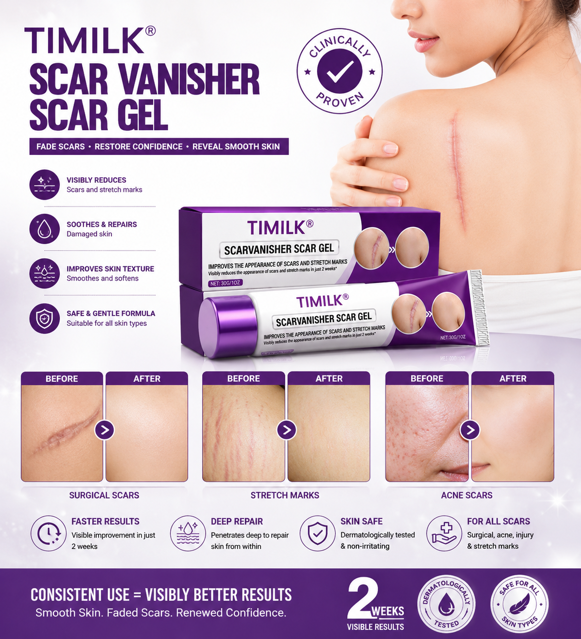 Timilk RegenScar Cream | Advanced Scar Care Cream | Acne Marks, Stretch Marks & Dark Spot Care | Skin Repair Moisturizing Cream