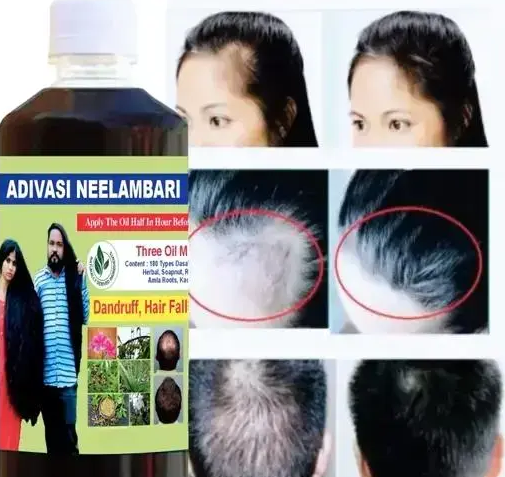 Adivasi Herbal Hair Oil – Natural Ayurvedic Hair Growth & Anti-Hair Fall Oil for Strong, Thick & Healthy Hair