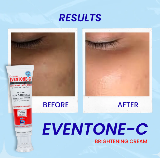 Eventone C Glutathione + Vitamin C Whitening and Glowing Cream – Advanced Brightening & Radiance Boosting Moisturizer